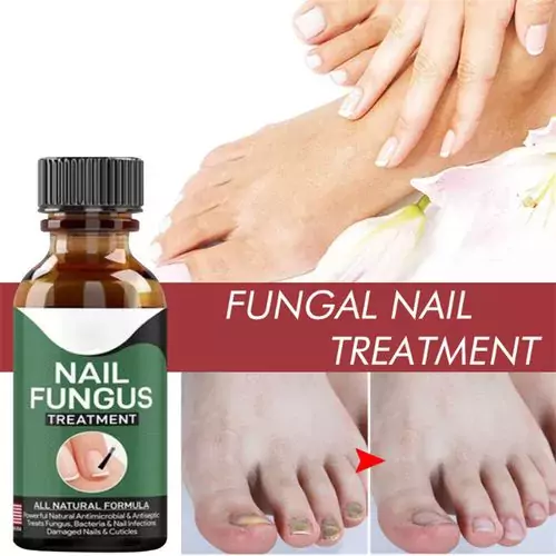 nail fungus treatment medicine in pakistan